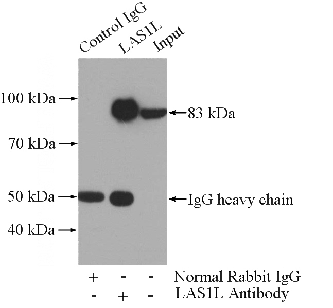 IP Result of anti-LAS1L (IP:Catalog No:112151, 4ug; Detection:Catalog No:112151 1:1000) with HEK-293 cells lysate 1200ug.