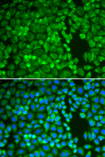 Immunofluorescence - IDE Polyclonal Antibody 
