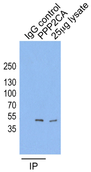 IP result of anti-PPP2CA (Catalog No:114095 for IP and Detection) with HeLa cells.