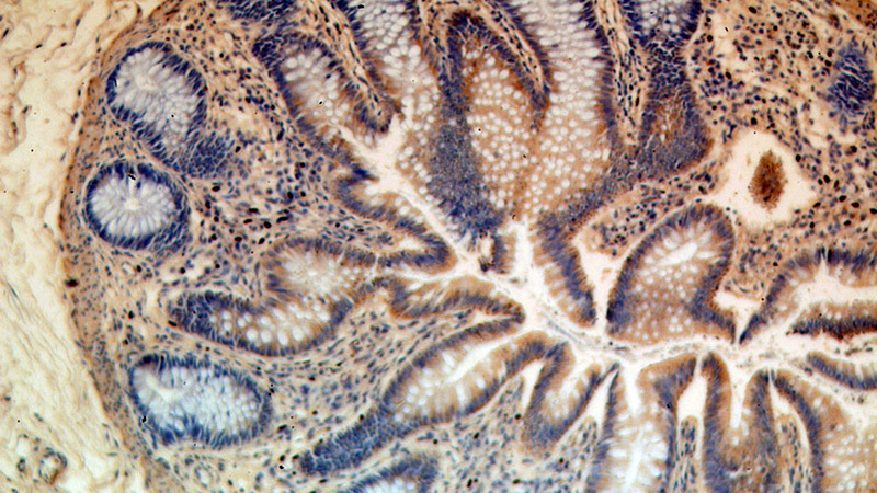 Immunohistochemical of paraffin-embedded human colon using Catalog No:117091(B3GNT3 antibody) at dilution of 1:100 (under 10x lens)