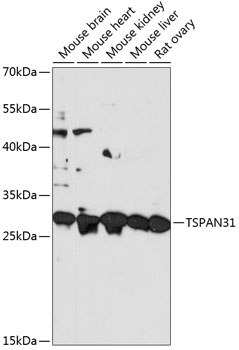 Western blot - TSPAN31 Polyclonal Antibody 