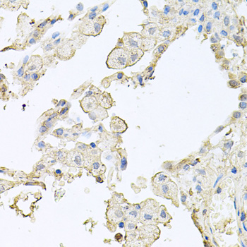 Immunohistochemistry - MMRN1 Polyclonal Antibody 