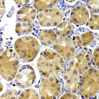 Immunohistochemistry - TRAF3 Polyclonal Antibody 