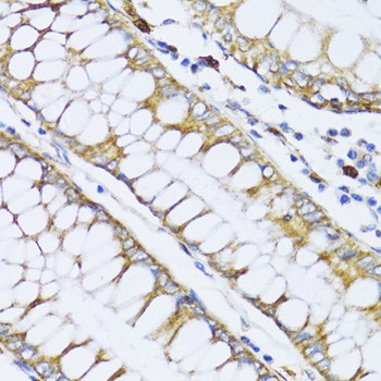 Immunohistochemistry - ALOX12 Polyclonal Antibody 