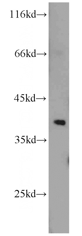 mouse brain tissue were subjected to SDS PAGE followed by western blot with Catalog No:115735(STRAP antibody) at dilution of 1:2000