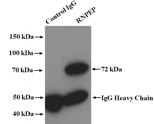 IP Result of anti-RNPEP (IP:Catalog No:114771, 4ug; Detection:Catalog No:114771 1:500) with A549 cells lysate 2000ug.