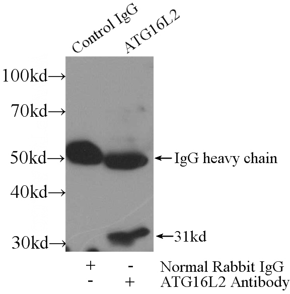 IP Result of anti-ATG16L2 (IP:Catalog No:108292, 3ug; Detection:Catalog No:108292 1:700) with mouse testis tissue lysate 4800ug.