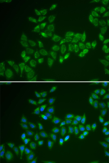 Immunofluorescence - CRAT Polyclonal Antibody 
