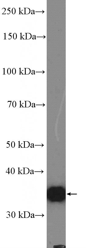 mouse brain tissue were subjected to SDS PAGE followed by western blot with Catalog No:108845(CAPZA2 Antibody) at dilution of 1:1000