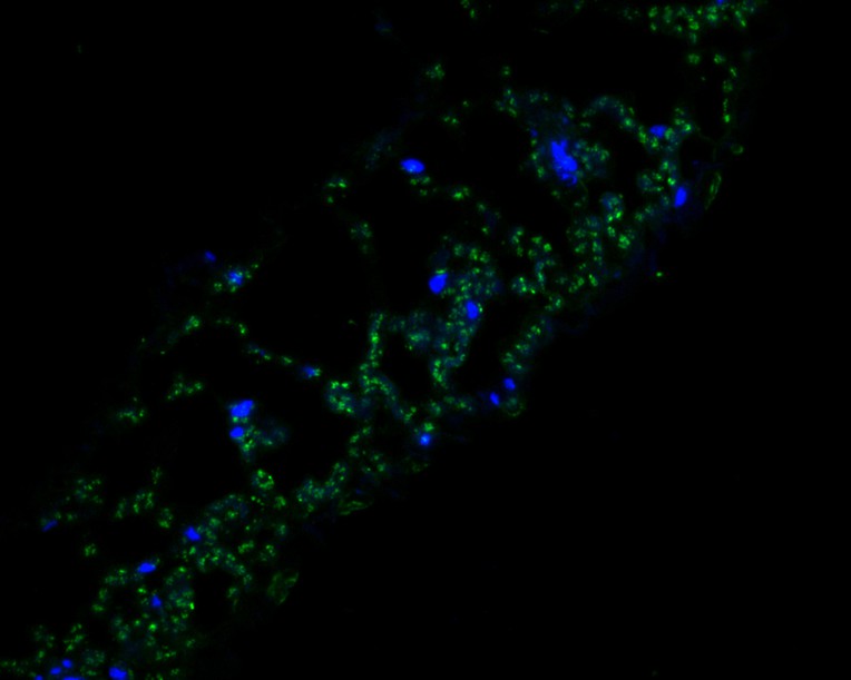 Fig1:; Immunofluorescence staining of paraffin- embedded A. thaliana using anti-FAB1A rabbit polyclonal antibody.The section was pre-treated using heat mediated antigen retrieval with Tris-EDTA buffer (pH 9.0) for 20 minutes. The tissues were blocked in 10% negative goat serum for 1 hour at room temperature, washed with PBS, and then probed with 176619# at 1/100 dilution for 10 hours at 4℃ and detected using Alexa Fluor® 488 conjugate-Goat anti-Rabbit IgG (H+L) Secondary Antibody at a dilution of 1:500 for 1 hour at room temperature.