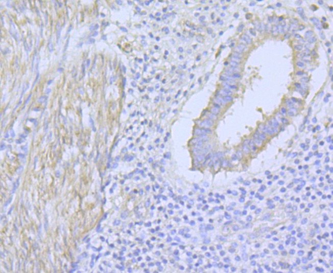 Fig6: Immunohistochemical analysis of paraffin-embedded mouse heart tissue using anti-CACNA1C antibody. Counter stained with hematoxylin.