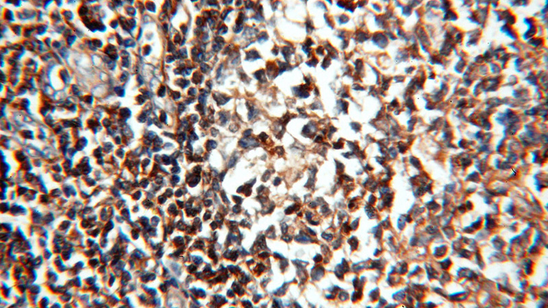 Immunohistochemical of paraffin-embedded human tonsil using Catalog No:111489(HMHA1 antibody) at dilution of 1:100 (under 40x lens)