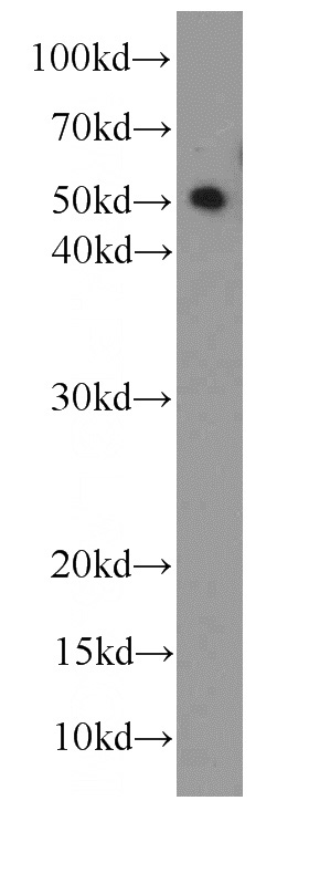 HepG2 cells were subjected to SDS PAGE followed by western blot with Catalog No:107580(Alpha-1-Antitrypsin antibody) at dilution of 1:1000