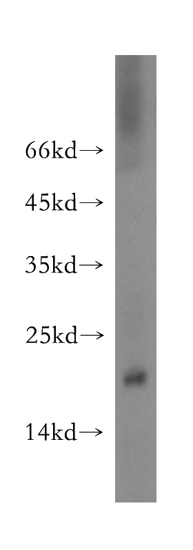 mouse liver tissue were subjected to SDS PAGE followed by western blot with Catalog No:114727(RNASE13 antibody) at dilution of 1:1500