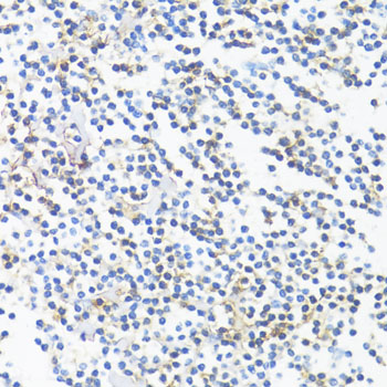 Immunohistochemistry - HLA-DRB3 Polyclonal Antibody 