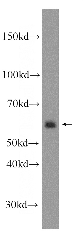 COLO 320 cells were subjected to SDS PAGE followed by western blot with Catalog No:110318(EEPD1 Antibody) at dilution of 1:600