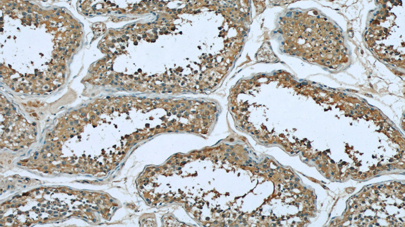 Immunohistochemical of paraffin-embedded human testis using Catalog No:107081(Bcl-xL antibody) at dilution of 1:50 (under 10x lens)