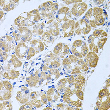 Immunohistochemistry - STRN3 Polyclonal Antibody 