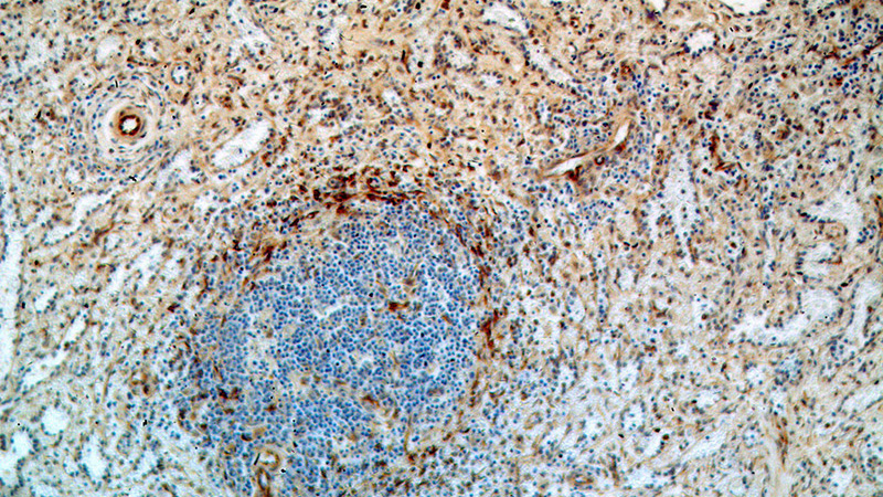 Immunohistochemical of paraffin-embedded human spleen using Catalog No:116105(TMEM173 antibody) at dilution of 1:100 (under 10x lens)