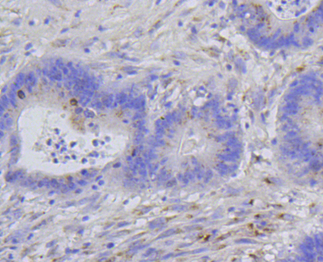 Immunohistochemistry - Phospho-Histone H1.3-T17/Histone H1.4-T17 mAb 