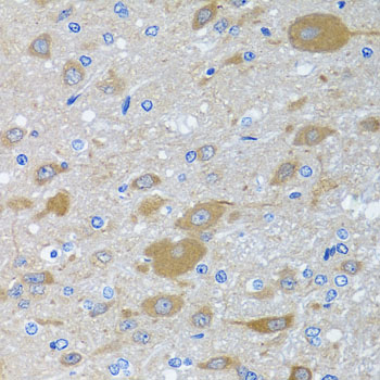Immunohistochemistry - EIF2S3 Polyclonal Antibody 