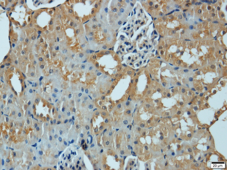 Immunohistochemistry - MMP1 Polyclonal Antibody 