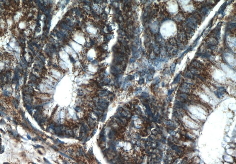 Immunohistochemistry of paraffin-embedded human colon tissue slide using Catalog No:115381(SMC4 Antibody) at dilution of 1:50 (under 40x lens)