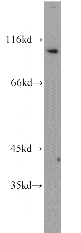 PC-3 cells were subjected to SDS PAGE followed by western blot with Catalog No:109633(CX3CL1 antibody) at dilution of 1:1000