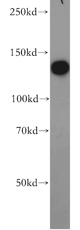 K-562 cells were subjected to SDS PAGE followed by western blot with Catalog No:114787(ROR1 antibody) at dilution of 1:500