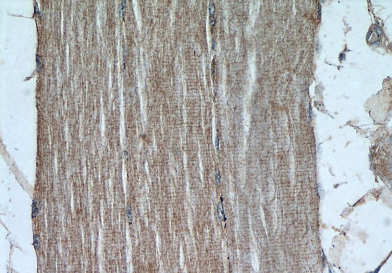 Immunohistochemical of paraffin-embedded human skeletal muscle using Catalog No:112801(MRAS antibody) at dilution of 1:50 (under 40x lens)