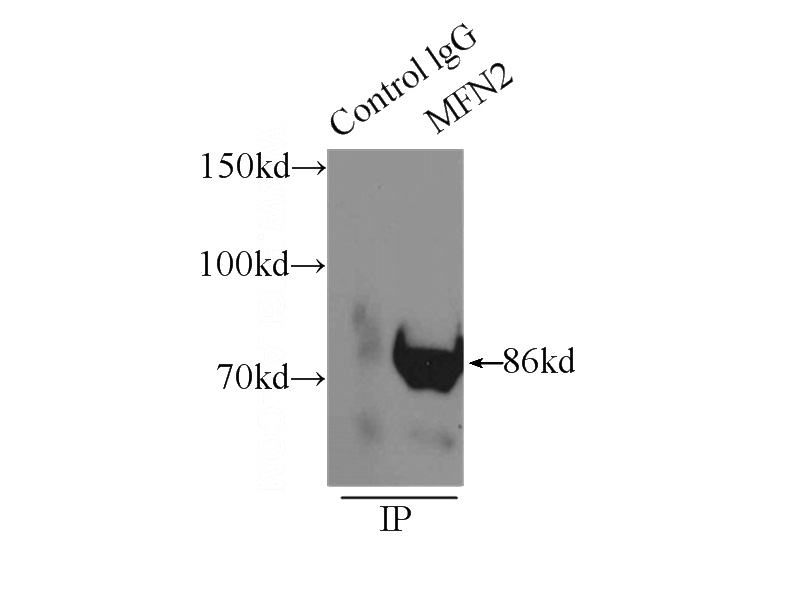 IP Result of anti-MFN2 (IP:Catalog No:112530, 3ug; Detection:Catalog No:112530 1:1000) with mouse kidney tissue lysate 8000ug.