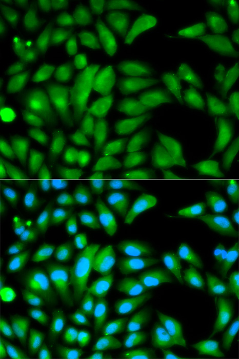 Immunofluorescence - Parkin Polyclonal Antibody 