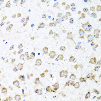 Immunohistochemistry - RPL36 Polyclonal Antibody 