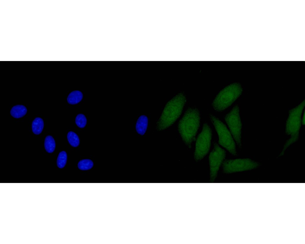Fig2:; ICC staining of CLIC2 in HepG2 cells (green). Formalin fixed cells were permeabilized with 0.1% Triton X-100 in TBS for 10 minutes at room temperature and blocked with 10% negative goat serum for 15 minutes at room temperature. Cells were probed with the primary antibody ( 1/50) for 1 hour at room temperature, washed with PBS. Alexa Fluor®488 conjugate-Goat anti-Mouse IgG was used as the secondary antibody at 1/1,000 dilution. The nuclear counter stain is DAPI (blue).