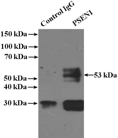 IP Result of anti-PSEN1-Specific (IP:Catalog No:114186, 4ug; Detection:Catalog No:114186 1:1000) with mouse kidney tissue lysate 4000ug.