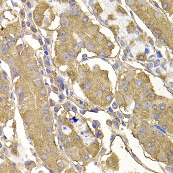 Immunohistochemistry - RASGRF1 Polyclonal Antibody 