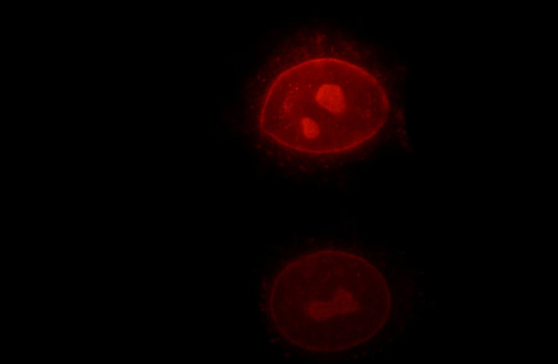 Immunofluorescent analysis of HepG2 cells, using RPIA antibody Catalog No:114808 at 1:25 dilution and Rhodamine-labeled goat anti-rabbit IgG (red).