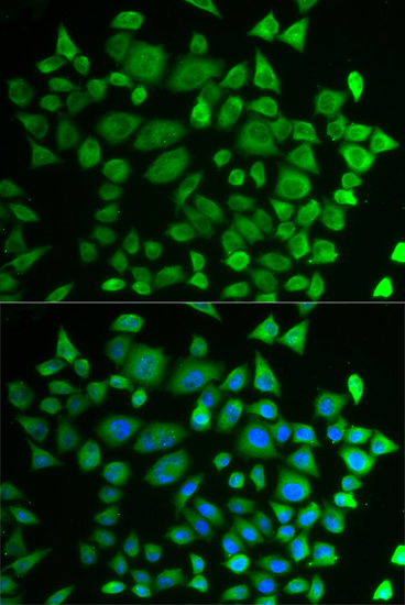 Immunofluorescence - P4HTM Polyclonal Antibody 