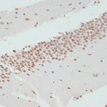 Immunohistochemistry - Phospho-PEA15-S104 pAb 