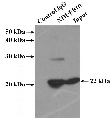 IP Result of anti-NDUFB10 (IP:Catalog No:113070, 4ug; Detection:Catalog No:113070 1:1000) with HepG2 cells lysate 1000ug.