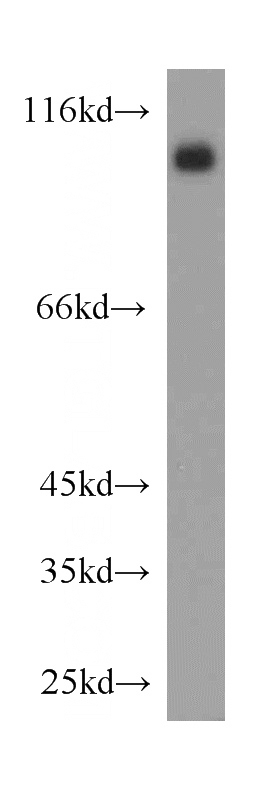 mouse kidney tissue were subjected to SDS PAGE followed by western blot with Catalog No:107736(ACE2 antibody) at dilution of 1:1000