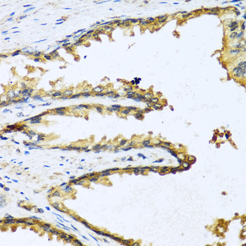 Immunohistochemistry - GNRH1 Polyclonal Antibody 