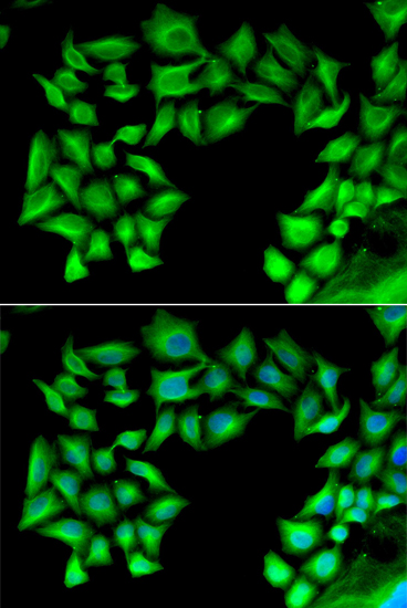 Immunofluorescence - TIMP4 Polyclonal Antibody 