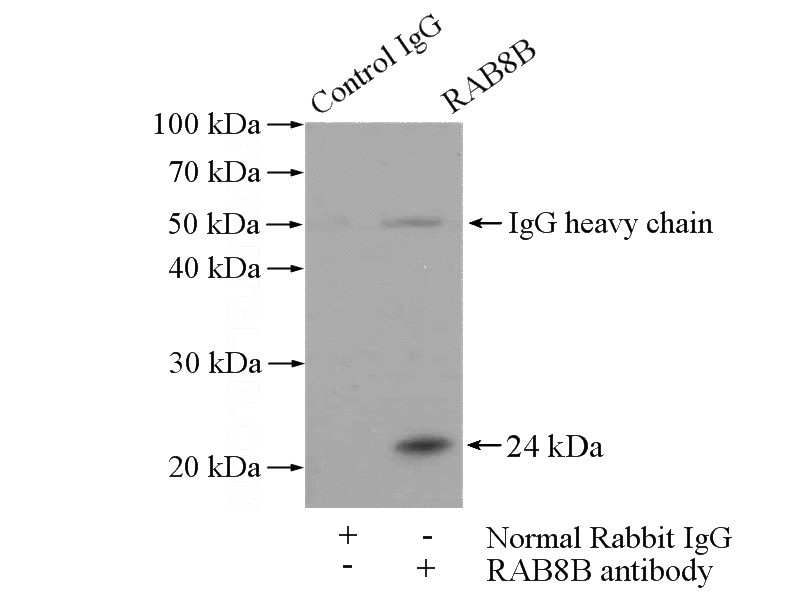 IP Result of anti-RAB8B (IP:Catalog No:114461, 4ug; Detection:Catalog No:114461 1:1000) with mouse brain tissue lysate 4000ug.