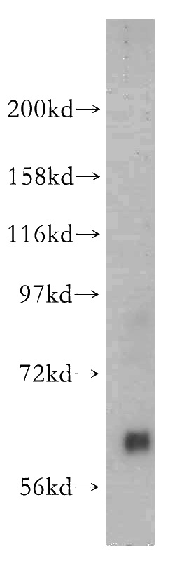 human placenta tissue were subjected to SDS PAGE followed by western blot with Catalog No:113905(EGFLAM antibody) at dilution of 1:400