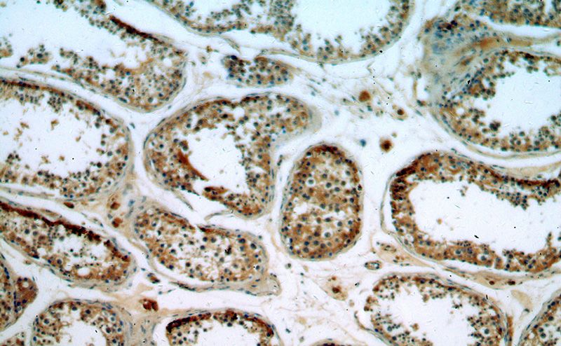 Immunohistochemical of paraffin-embedded human testis using Catalog No:111960(ITPR1-specific antibody) at dilution of 1:100 (under 10x lens)