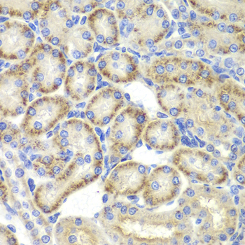 Immunohistochemistry - ST3GAL4 Polyclonal Antibody 