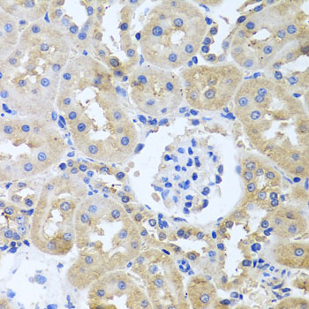 Immunohistochemistry - ITPKB Polyclonal Antibody 