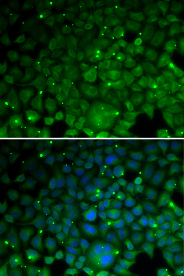 Immunofluorescence - CRYAA Polyclonal Antibody 