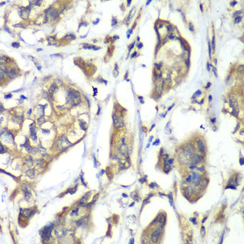 Immunohistochemistry - NFS1 Polyclonal Antibody 
